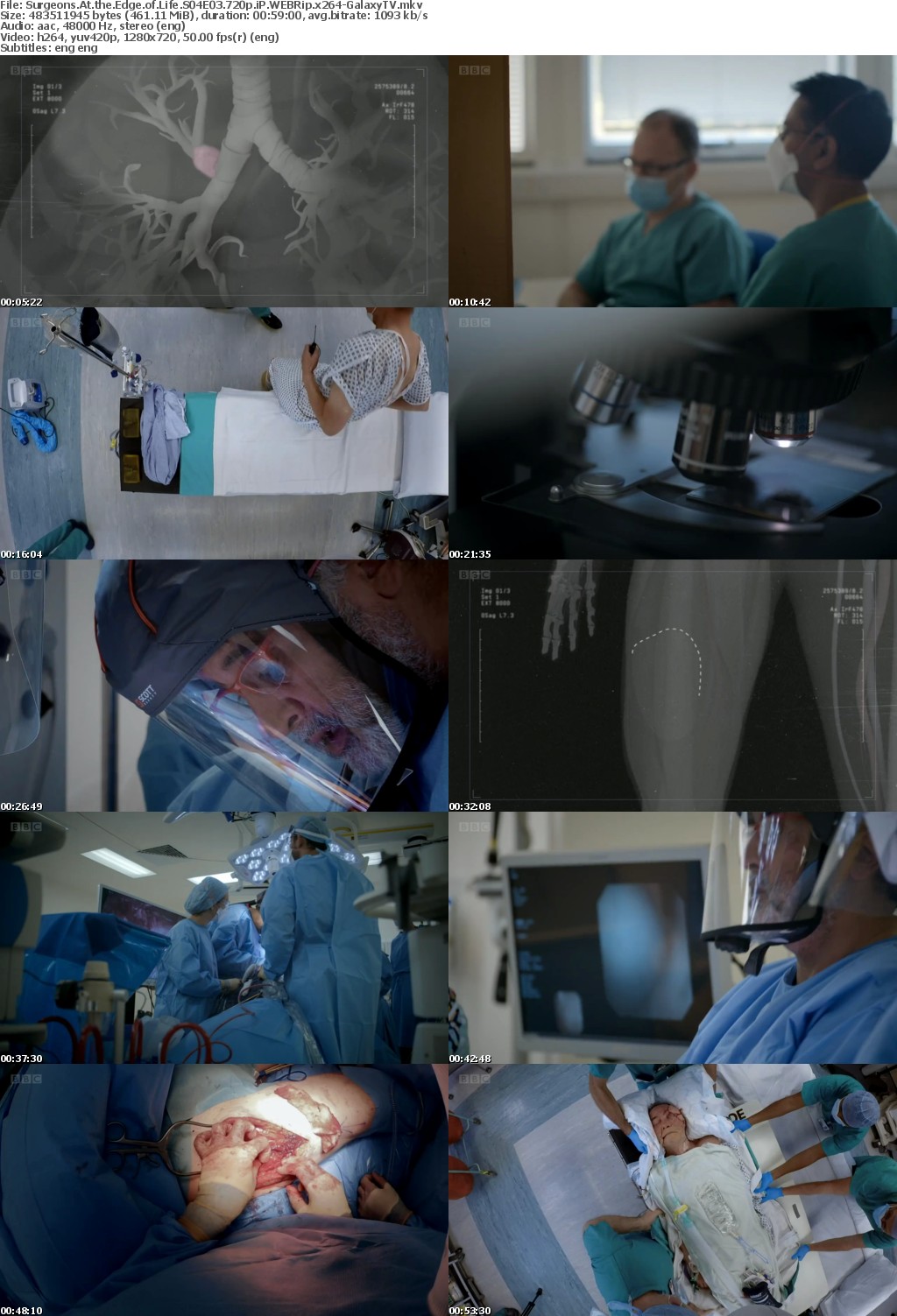 Surgeons At The Edge Of Life S04 COMPLETE 720p iP WEBRip x264-GalaxyTV