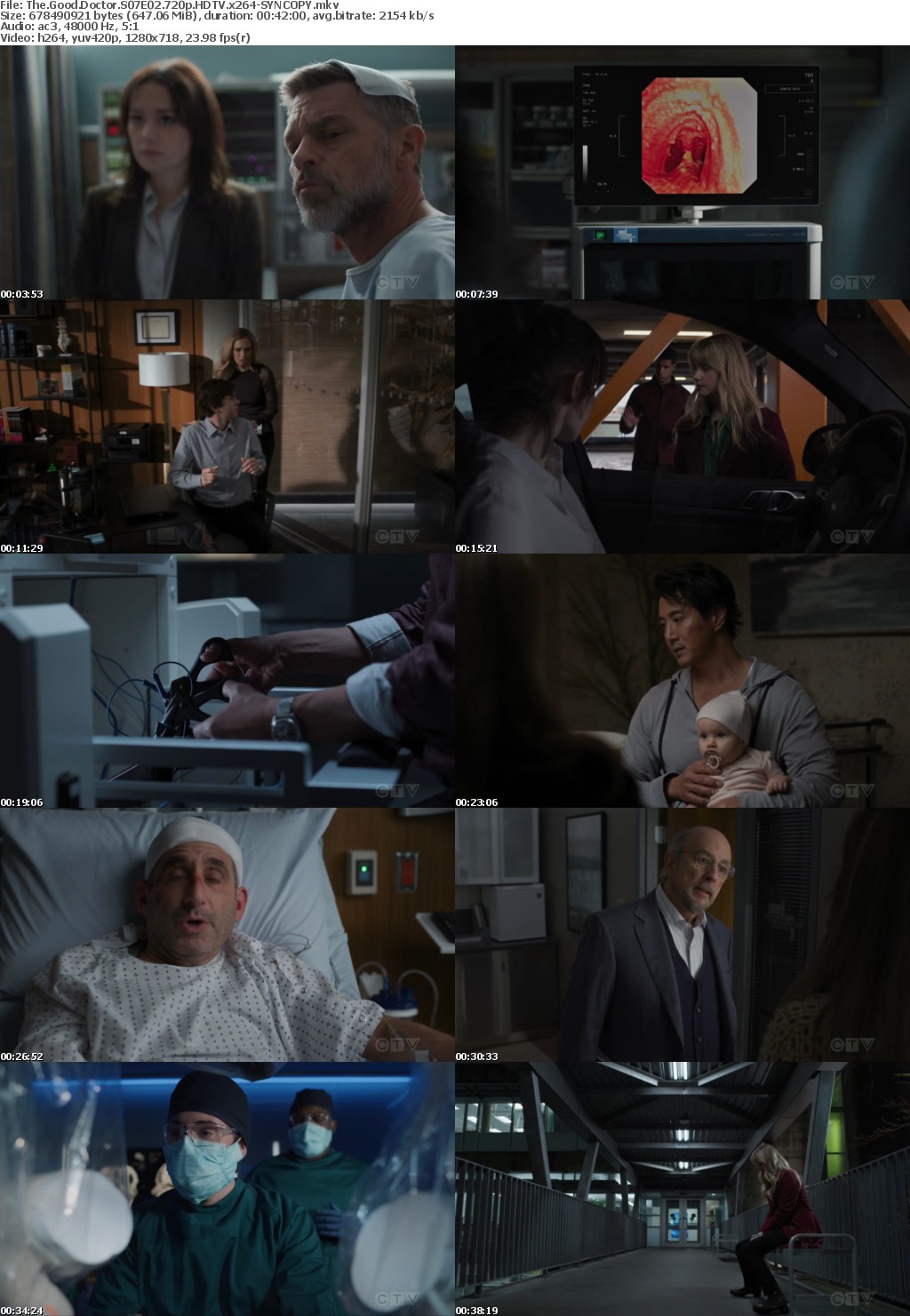 The Good Doctor S07E02 720p HDTV x264-SYNCOPY