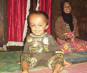 Maheder Hasibuan Bocah Warga Dusun Sialaman Julu Dengan Kepala Membengkak Butuh Perhatian 7494773467ef8bfb4ee8ad78f722ea61a641aea Maheder Hasibuan Bocah Warga Dusun Sialaman Julu Dengan Kepala Membengkak Butuh Perhatian